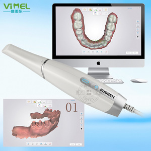 Escáner Dental Intraoral Fissen, Imágenes 3D, Modelado de Restauración de Ortodoncia Sin Pulverización de Polvo - Product Image 1
