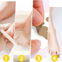 Patchs et coussinets multi-usages pour ongles incarnés, sans colle, en tissu non tissé, autocollants pour ongles