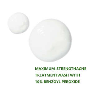 Nettoyant Visage OEM ODM au Peroxyde de Benzoyle 10% – Nettoyage Profond, Élimination de l'Acné, Exfoliation des Peaux Mortes, Nettoyage des Pores, Contrôle du Sébum, Soin du Visage - Product Image 2