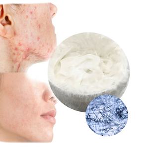 1000G Acne-Porne Gezichtscrème Bleekcrème Voor Donkere Huidvlekkenverwijderaar Private Label - Product Image 3