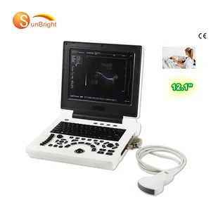 12.1" screen laptop human use medical ultrasonic obstetrics Gynecology ultrasound scanner price