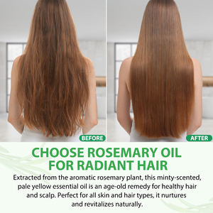 NiFEISHI 30ml 100% Pure Natural Organics Rosemary <span class=keywords><strong>Oil</strong></span> Óleo Essencial de Fortalecimento do Cabelo para Todos os Tipos de Cabelo - Product Image 4