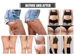 <span class=keywords><strong>Precio</strong></span> de fábrica mujeres Cuerpo Adelgazante drenaje linfático masaje aire <span class=keywords><strong>presoterapia</strong></span> traje terapia máquina para salón de belleza - Product Image 5