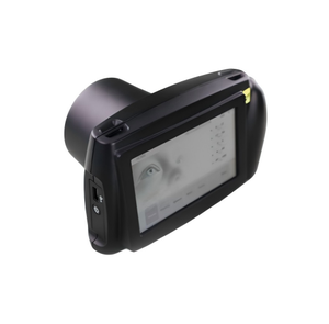 เครื่องตรวจวัดสายตาแบบพกพา Opto-Cam ใช้งานง่าย รวดเร็ว พกพาสะดวก สำหรับการตรวจคัดกรองพารามิเตอร์ด้านการมองเห็น แบบตาเดียวและสองตา - Product Image 2