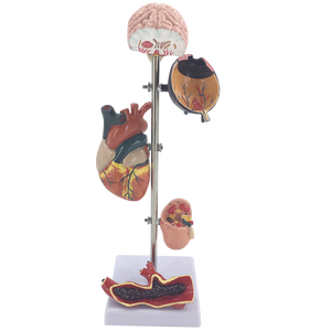 Анатомические модели для демонстрации диабета - Product Image 1