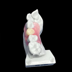 Prothèse <span class=keywords><strong>dentaire</strong></span> partielle amovible en résine flexible, invisible et incassable |   pour les laboratoires ou les cliniques | Fabriqué en Chine - Product Image 4