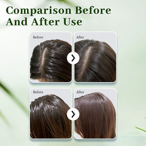 Private Label Custom Logo Organic Rosemary Oil Biotin Onion Hair Growth <strong>Shampoo</strong> Vegan Hair Loss Nourishing Strengthening <strong>Shampoo</strong> - Product Image 2