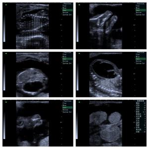 Appareil d'<span class=keywords><strong>échographie</strong></span> vétérinaire ultra-portable à écran tactile T6, sonde rectale électronique pour la détection des maladies utérines et de gestation chez les animaux - Product Image 4