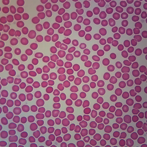 मेडिकल माइक्रोस्कोप स्लाइड ब्लड स्मीयर के लिए निर्धारित रक्त परीक्षण माइक्रोस्कोप स्लाइड - Product Image 3