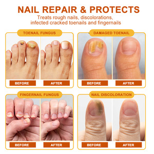 Crème réparatrice pour ongles antifongique au <span class=keywords><strong>venin</strong></span> d'abeille efficace Pommade de soin des ongles des pieds 20g - Product Image 2