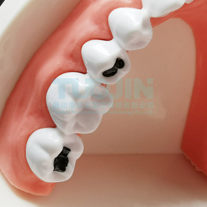 Modello Dentale Didattico per Bambini, Modello di Cura Dentale, Modello di Studio Odontoiatrico per Insegnamento e Carie, Tipodonte - Product Image 4