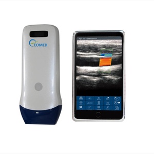 Échographe Doppler Couleur Portable Sans Fil 128 Éléments Sonde Linéaire 7.5 & 10 MHz à Bon Prix Modèle CU12 - Product Image 1