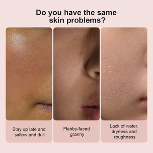 OEM/Private Label 50ml Niacinamide Crème éclaircissante et blanchissante <span class=keywords><strong>pour</strong></span> le visage cible <span class=keywords><strong>les</strong></span> <span class=keywords><strong>taches</strong></span> brunes et <span class=keywords><strong>les</strong></span> cicatrices d'acné au teint terne - Product Image 5