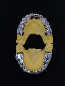 Rejilla Dental Personalizada de Hip Hop, con Incrustaciones de Plata 925 y Moissanita VVS, Corte Permanente 12x12, para Hombres - Product Image 3