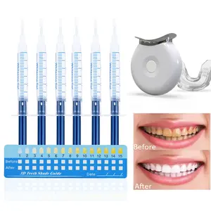 Best At-Home Teeth-Whitening Kits for a Brighter Smile