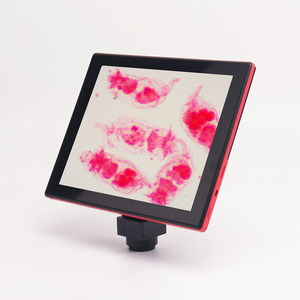 Phenix <strong>LCD</strong> <strong>Microscope</strong> <strong>with</strong> Digital <strong>LCD</strong> <strong>Screen</strong> 9.7inch Touch Pad Built-in 5.0MP <strong>Microscope</strong> Camera - Product Image 3