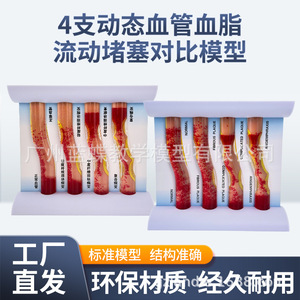 Modèle de simulation vasculaire d'occlusion et d'hyperlipidémie ; dynamiques pathologiques de l'athérosclérose et de la thrombose artérielle ; - Product Image 3
