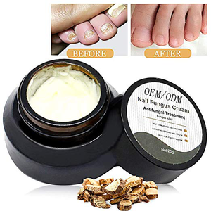 OEM/ODM <span class=keywords><strong>Mycose</strong></span> des Ongles <span class=keywords><strong>Crème</strong></span> Arrêt <span class=keywords><strong>Pied</strong></span> Champignon Champignon de Clou <span class=keywords><strong>Crème</strong></span> - Product Image 3