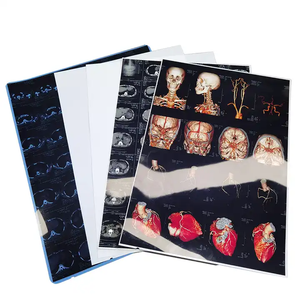 فيلم أشعة سينية طبي أبيض 125/150/180 ميكرون للتصوير الإشعاعي بتقنية الليزر والطباعة النافثة للحبر لأنظمة التصوير الرقمي والتصوير بالرنين المغناطيسي - Product Image 3