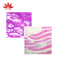 individual popular pathological educational human pathology microscope prepared slides