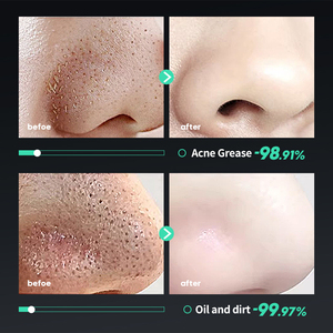 BIOAQUA SADOER Cuidado de los hombres Etiqueta privada Limpieza profunda Espinillas Eliminar Parche de Nariz de carbón de bambú negro Tira de máscara de nariz - Product Image 5