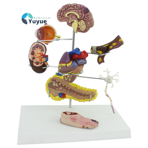 Modelo de Enseñanza Médica - <span class=keywords><strong>Diabetes</strong></span> y Complicaciones, Demostración de Órganos Humanos de 8 Partes - Product Image 1