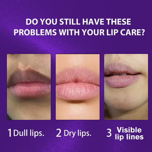 Bálsamo Labial al por Mayor de Fábrica para Eliminar Labios Oscuros, Bálsamo Nutritivo Profundo para el Cuidado de los Labios, para Marca Privada - Product Image 5