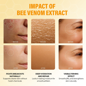 Crème corporelle apaisante pour les articulations et les os, à base de venin d'abeille naturel, à absorption rapide, marque privée, pour le dos, le cou, les mains, les genoux - Product Image 3