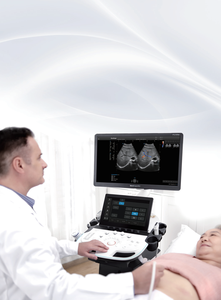 Sonosbape P12 elite ecografo doppler, sistem diagnostik <span class=keywords><strong>ultrasound</strong></span> digital dengan panduan transduser biopsi, peralatan rumah sakit - Product Image 3