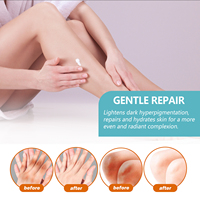 Crème réparatrice pour l'épiderme noir - Répare les taches sombres sur les aisselles, les bras et les genoux, hydrate et éclaircit la peau, ODM/OEM