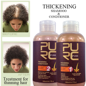 <span class=keywords><strong>Shampoo</strong></span> Anticaduta allo Zenzero all'Ingrosso, <span class=keywords><strong>Shampoo</strong></span> e Balsamo Professionale <span class=keywords><strong>per</strong></span> <span class=keywords><strong>Crescita</strong></span> Rapida <span class=keywords><strong>dei</strong></span> <span class=keywords><strong>Capelli</strong></span> - Product Image 2