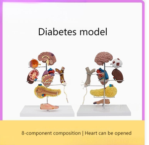 Modelo de Enseñanza Médica, Modelo de Diabetes para Educación en Endocrinología y Fisiopatología - Product Image 2