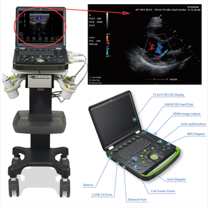 Kanistar mesin <span class=keywords><strong>Ultrasound</strong></span> portabel, peralatan diagnostik ultrasonik B untuk rumah sakit - Product Image 2