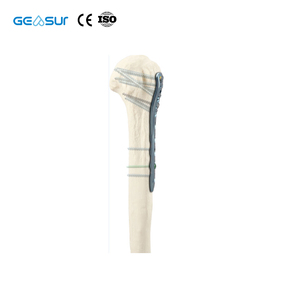 Pelat Kompresi Pengunci Titanium Leher Humerus Geasure Kelas III untuk <span class=keywords><strong>Trauma</strong></span> Tulang Ortopedi dengan Desain Kontur Anatomi untuk Tulang - Product Image 2