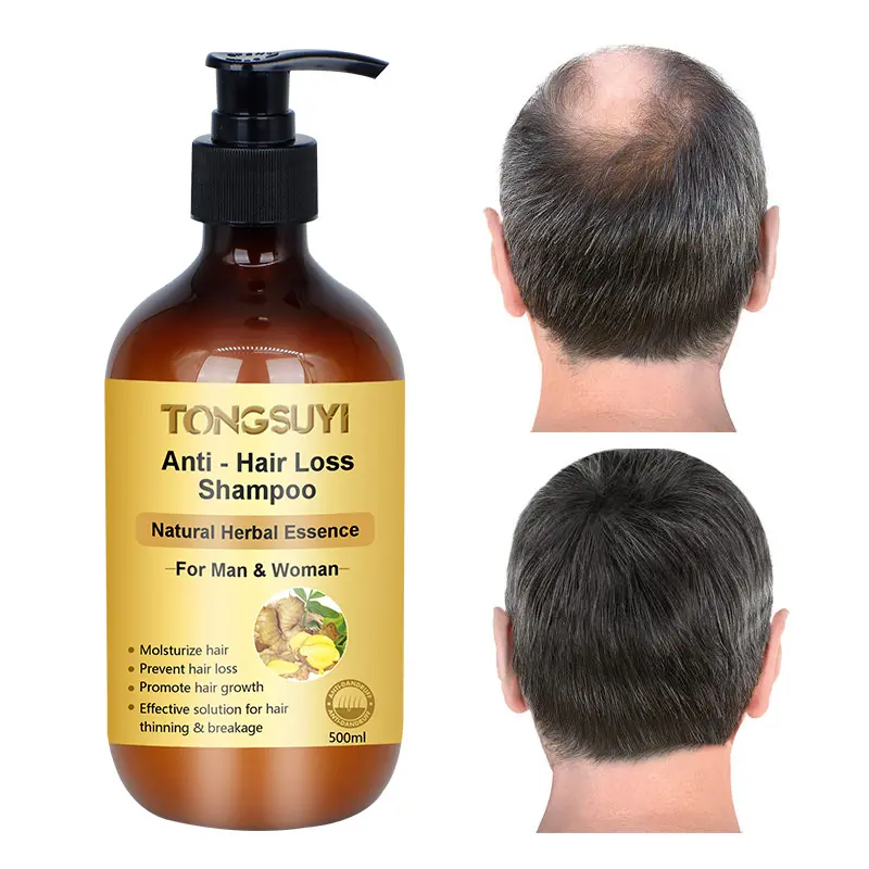 Vente en gros logo OEM shampooing de haute qualité pour cheveux, ail, romarin, gingembre, repousse des cheveux, anti-chute