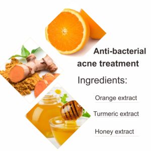 OCarly Lotion Corporelle Personnelle Éclaircissante Réparatrice Peau au Curcuma Vitamine C Hydratante Nourrissante Anti-Acné - Product Image 5