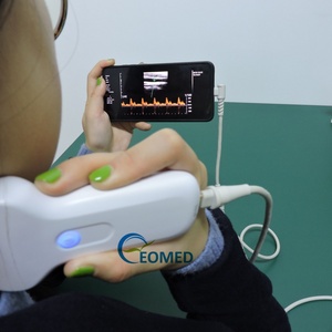 Sonde linéaire à 128 éléments 7,5/10 MHz pour échographie vétérinaire et humaine, portable sans fil, USB/Wi-Fi CU07, CU08 – Approvisionnement direct - Product Image 5