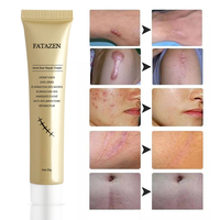 Crème anti-cicatrices pour estomper les marques d'acné, réduire les vergetures, corriger la pigmentation, lisser la texture, faible MOQ, vente en gros