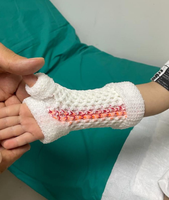 Manchon de plâtre en polymère pour rééducation orthopédique post-chirurgie – Fournitures de thérapie pour fractures