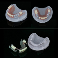 Résine d'impression 3D pour prothèses dentaires flexibles 1KG pour prothèses amovibles temporaires
