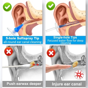 Máquina de Irrigación <span class=keywords><strong>para</strong></span> Limpieza de Oídos con Agua, Irrigador de Oídos Seguro y Efectivo - Product Image 4