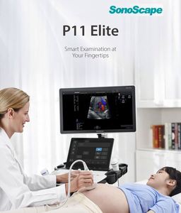 Appareil d'échographie Doppler couleur Sonoscape P11Elite 4D/5D avec fonction IA, chariot, pour les veines, le bébé, l'abdomen - Product Image 2