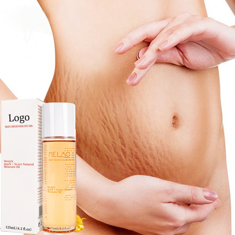 125ml stretch mark oil