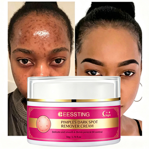 Crème Visage Éclaircissante et Hydratante en Gros pour Uniformiser le Teint, Puissante Contre les Imperfections et les Taches Brunes - Product Image 1