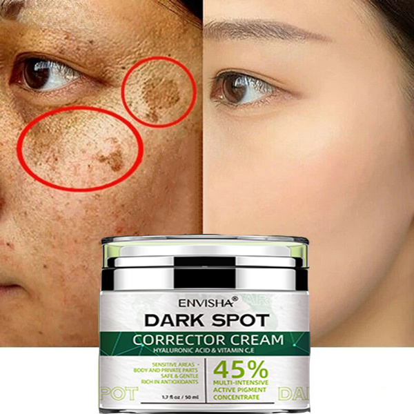 Free Sample Dark Spot Corrector Brightening Blemish Remover Natural Korea Skin Care Face Whitening Freckle Cream