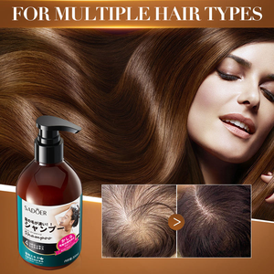 Shampoo anti-chute de cheveux SADOER, nettoie et élimine les pellicules avec une mousse douce <span class=keywords><strong>qui</strong></span> n'irrite pas <span class=keywords><strong>le</strong></span> <span class=keywords><strong>cuir</strong></span> <span class=keywords><strong>chevelu</strong></span> - Product Image 1