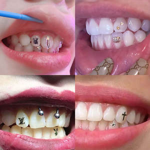 Vente en gros d'ensemble de pierres précieuses pour dents en plaqué or 18 carats Meilleur <span class=keywords><strong>prix</strong></span> Bijoux dentaires en alliage Décoration de dents personnalisée - Product Image 4
