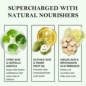 Serum Wajah Anti Penuaan, produk perawatan kulit Anti jerawat, Serum menyusutkan pori-pori, - Product Image 5