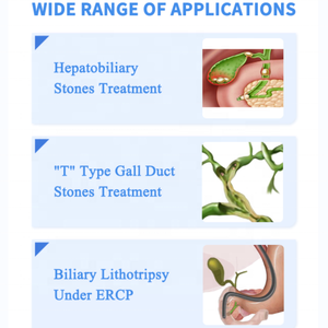 Fabricant médical puissant Ponte Urology, système d'électrohydraulique bipolaire EHL pour lithotritie biliaire pour cholangioscopie - Product Image 3