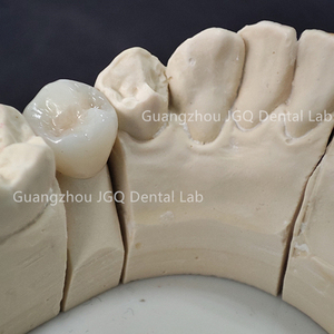 OEM/ODM servizi di laboratorio odontoiatrico perfetto aspetto belle corone in ceramica di <span class=keywords><strong>Zirconia</strong></span> con gomma realistica in Cina laboratorio odontoiatrico - Product Image 6